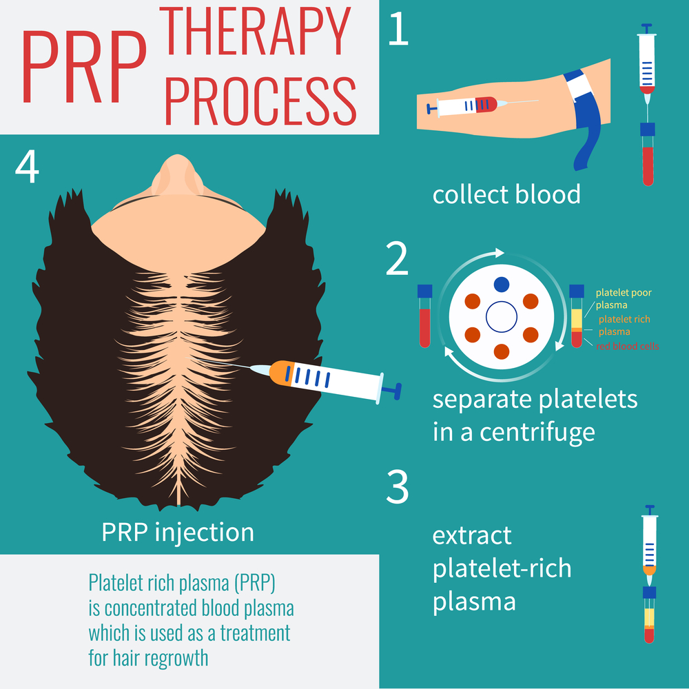 best-prp-therepy-in-pune