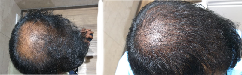 Best Doctors near me in Hair Loss Mangalore  Book Appointment Online   Credihealth
