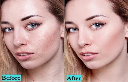 best-Skin-Lightening-treatment-in-pune-india